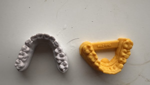 retainer-mould2026-03-30-23.15.49-300x169 165英镑搞了两副，便宜多了。 
