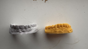 retainer-mould2026-03-30-23.16.01-300x169 我的实体牙模，这个是之前订的时候送的 